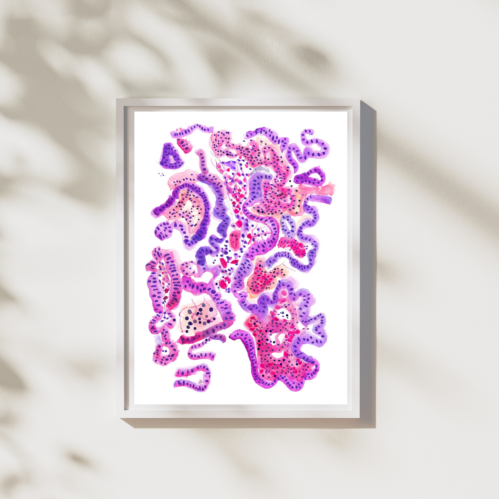 Cholangiocarcinoma Hepatobiliary Cancer Pathology Watercolor Print