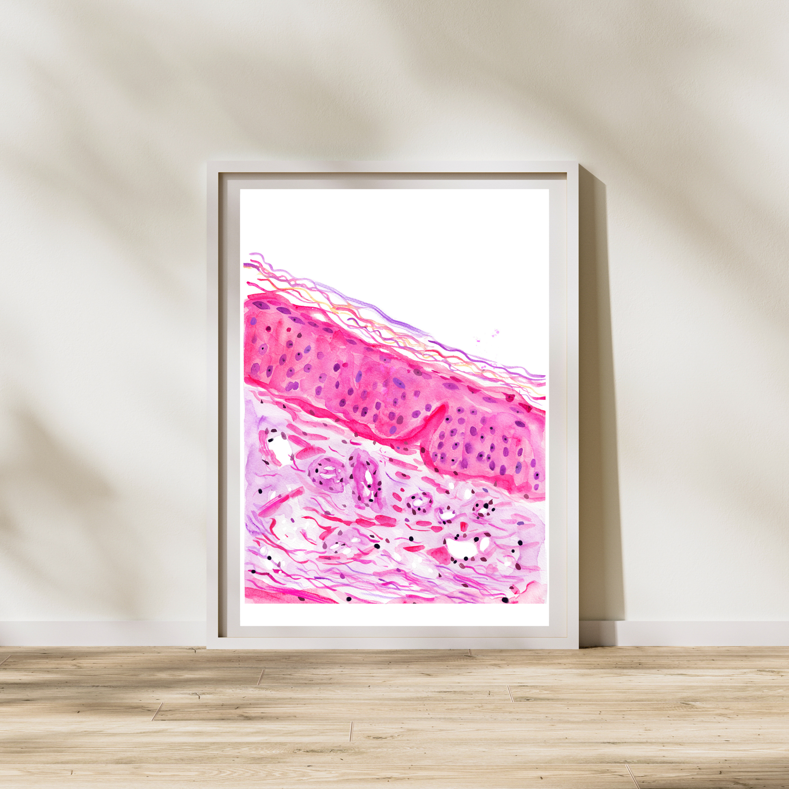 Sun Damaged Aging Skin Histology Art