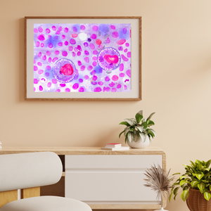 Hodgkin Lymphoma Watercolor Art Print