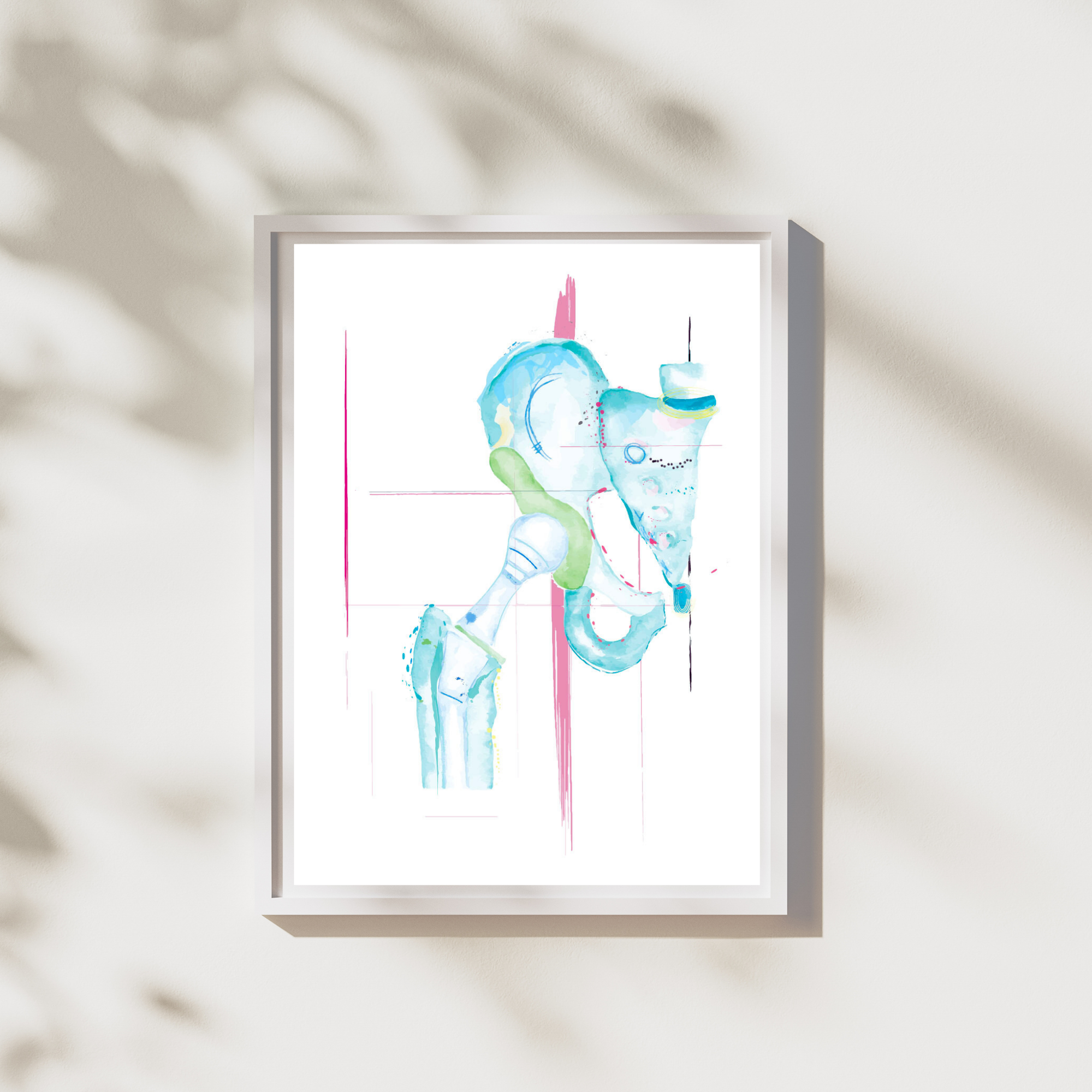 Hip Replacement Orthopedic Anatomy Art