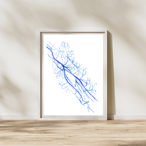 Arm Angiography