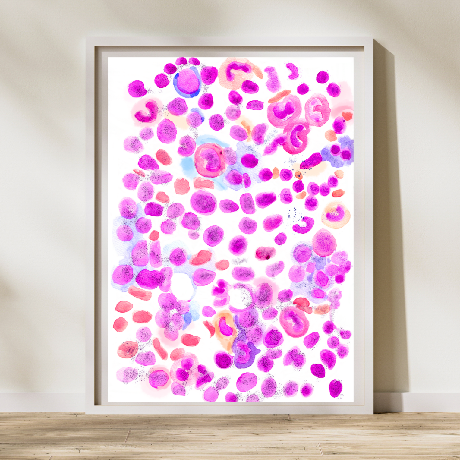 acute lymphoblastic leukemia watercolor art
