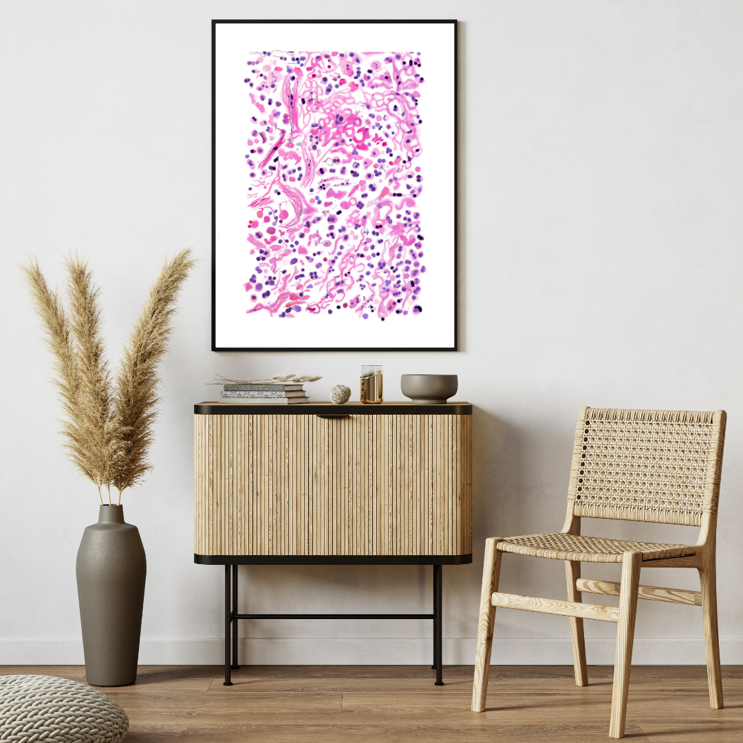 Pneumonia Histopathology Artwork