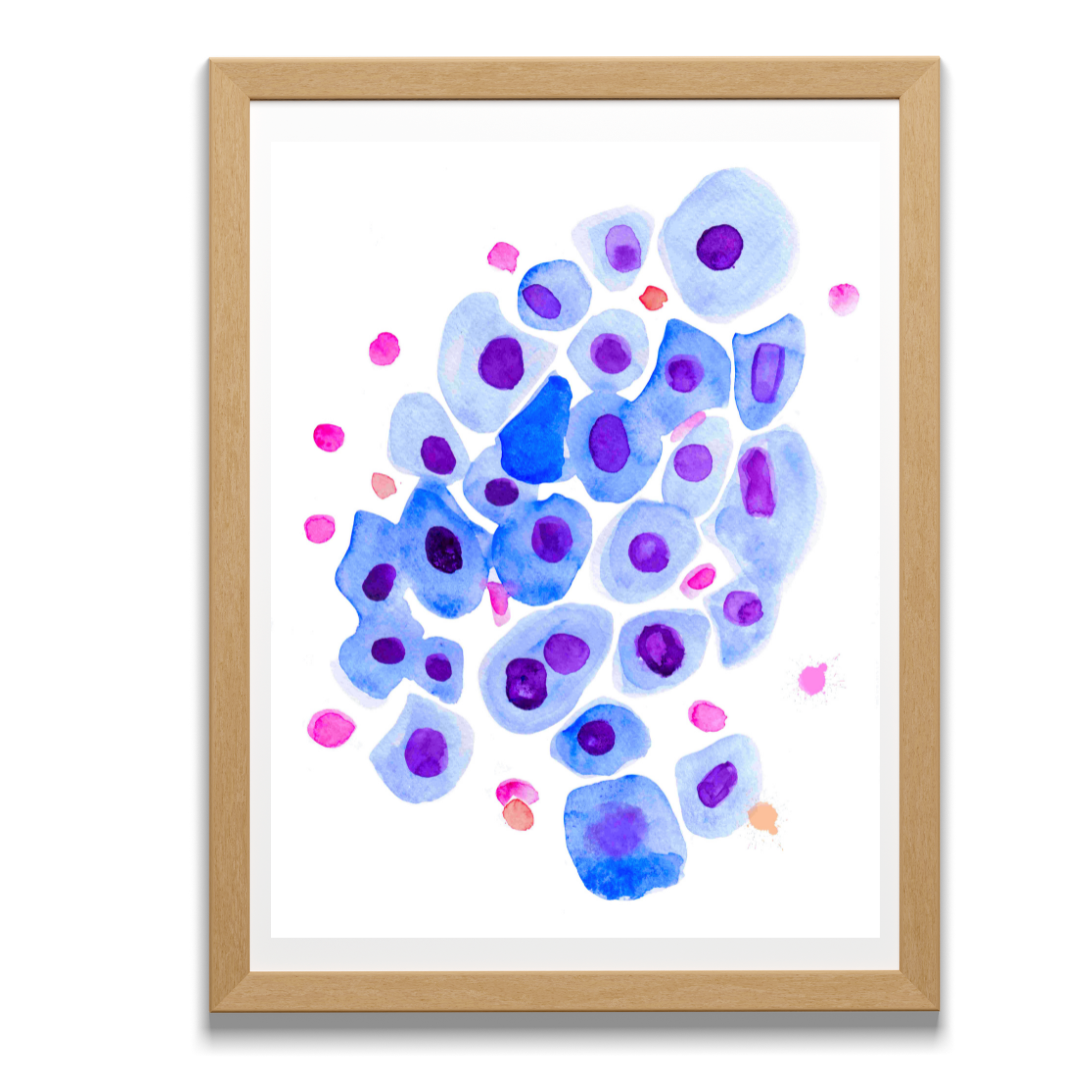 bronchial wash cytology art print
