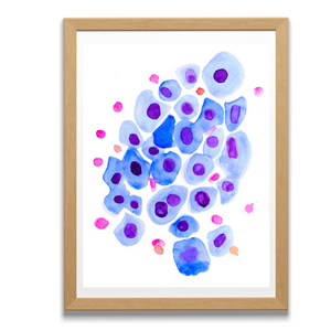 pneumocytology art
