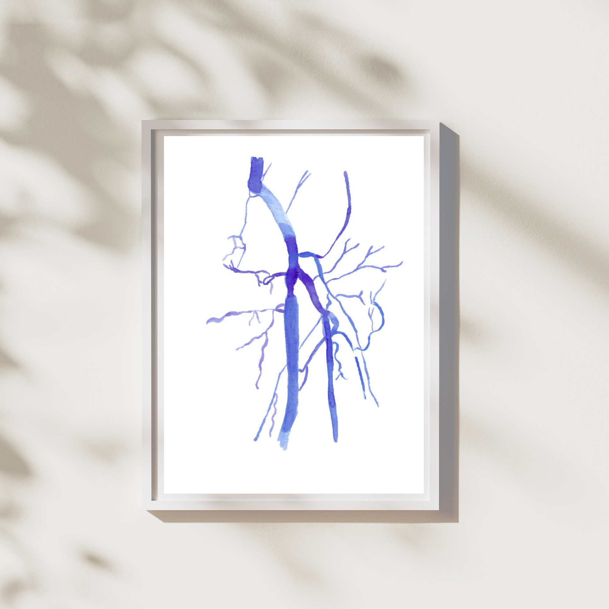 femoro-popliteal angiogram