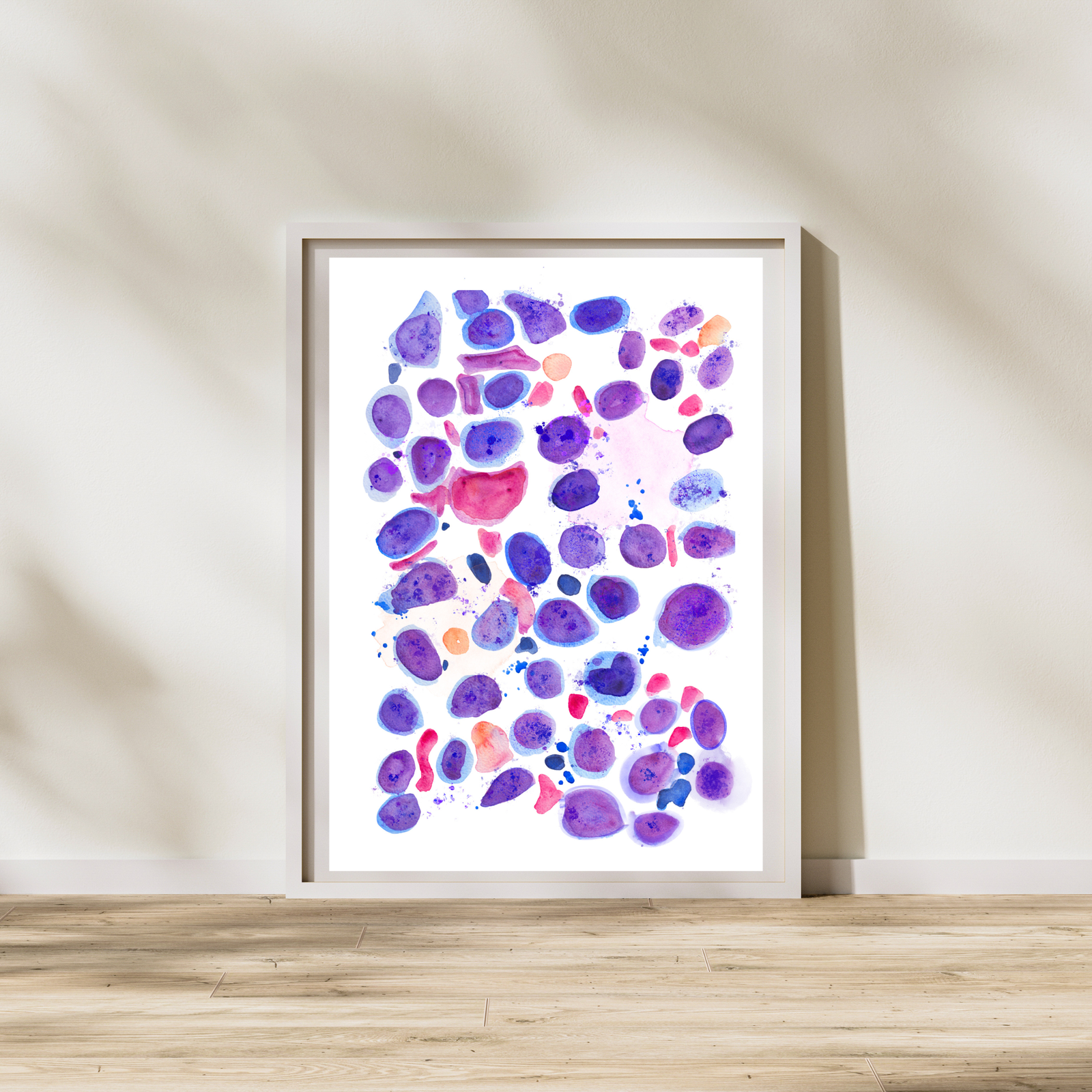 Veterinary Pathology - Dog Lymphoma Histopathology Art