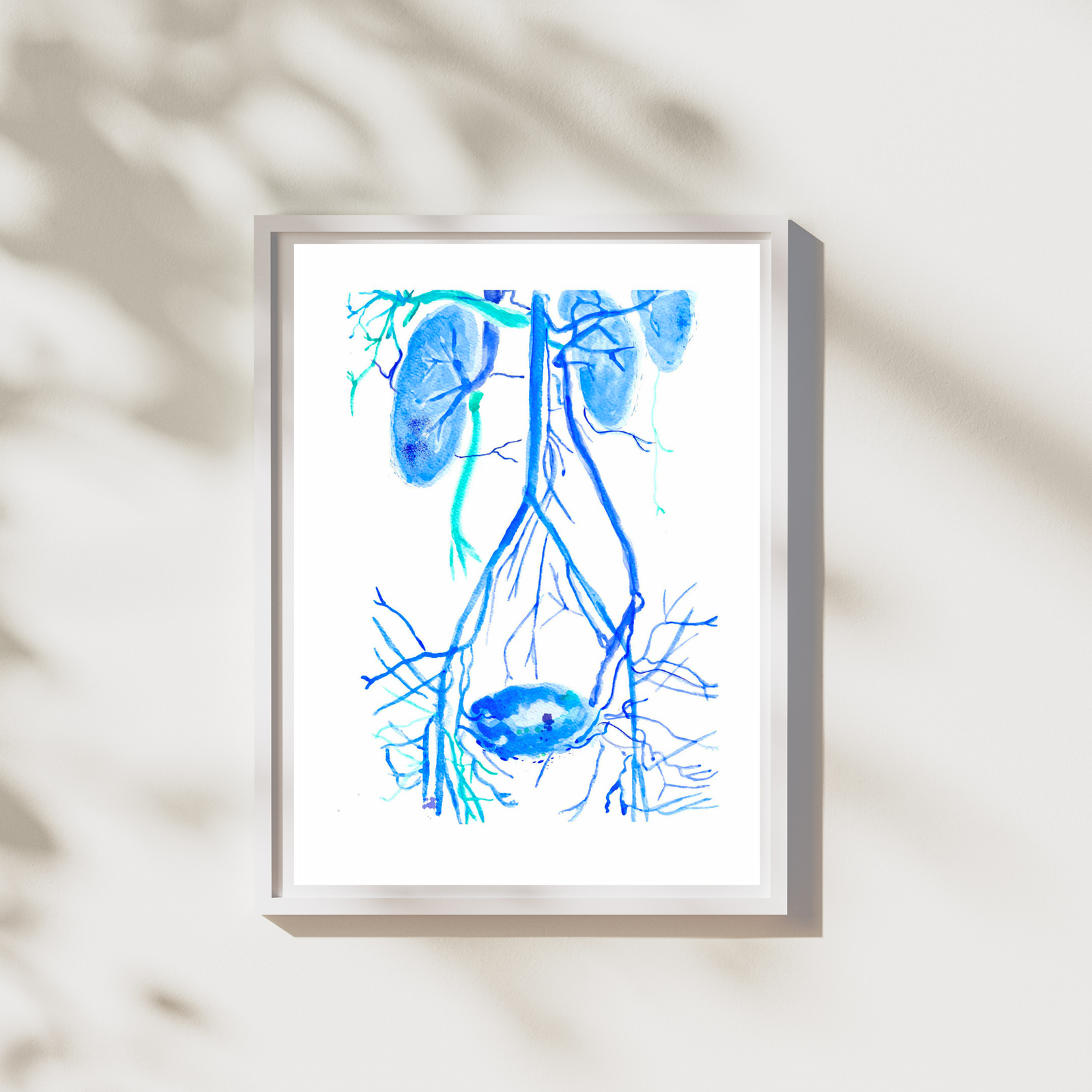 pelvic congestion watercolor art
