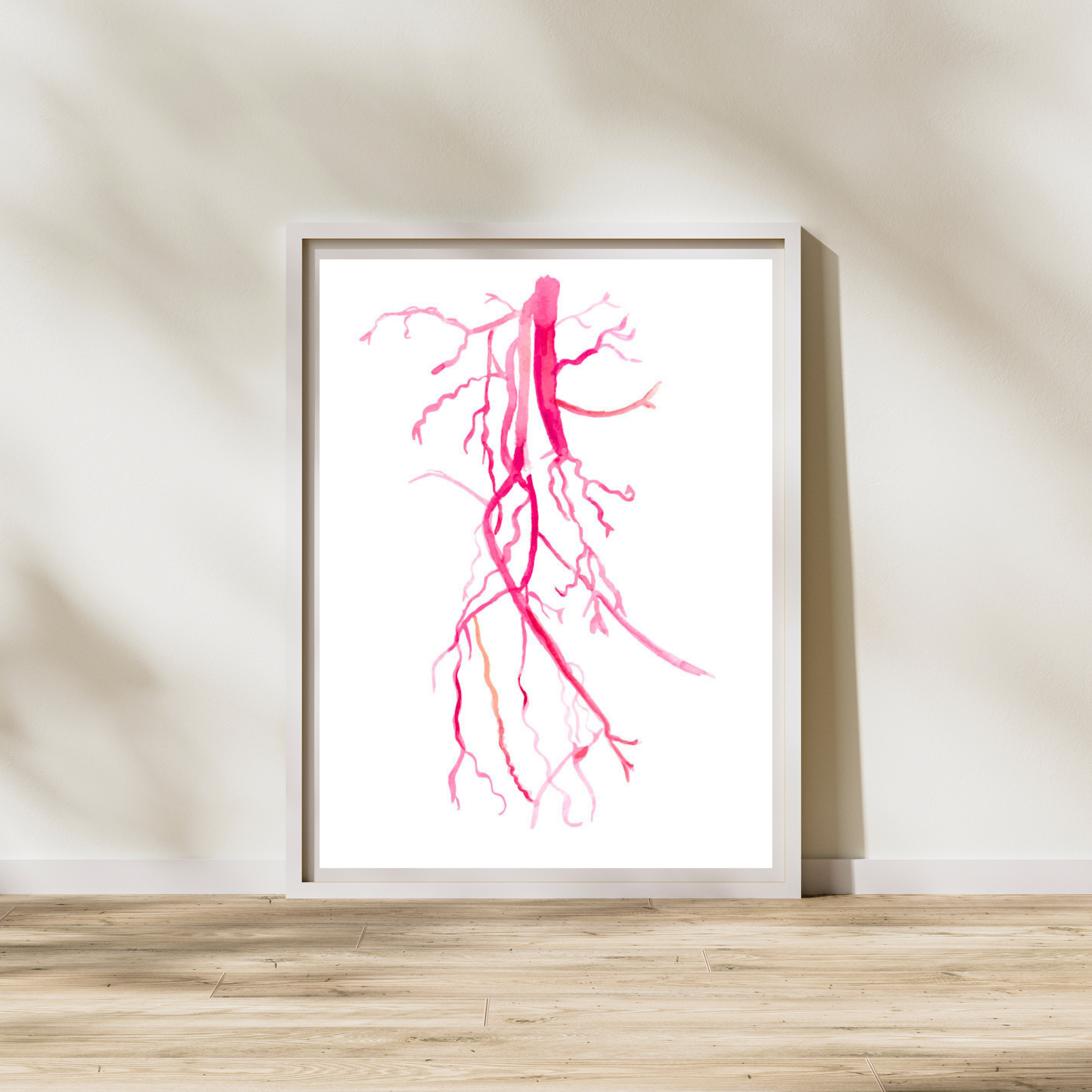 lower limb angiography dsa art print
