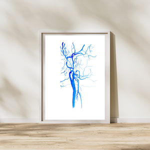 Carotid Angiography Post Stenting Watercolor Art Print