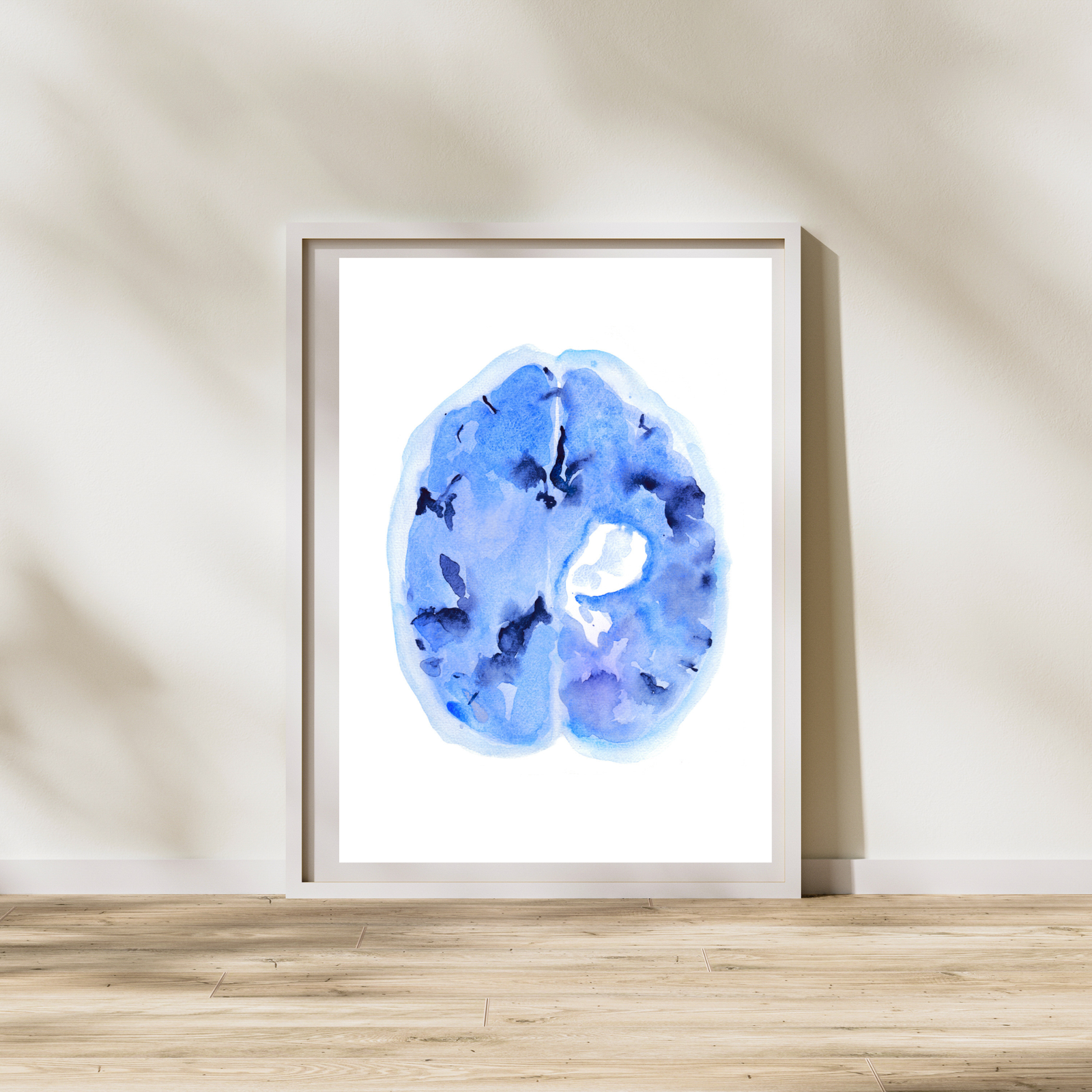 Hemorrhagic Stroke Watercolor Art Print