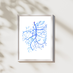 Mesenteric Arteries Angiography