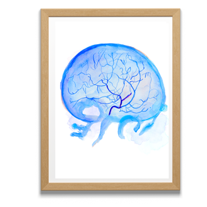Cerebral Angiography Art Print