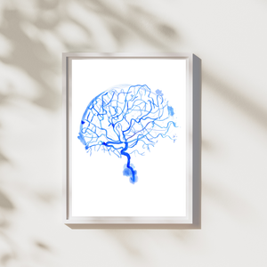 Cerebral Angiography Watercolor Art Print