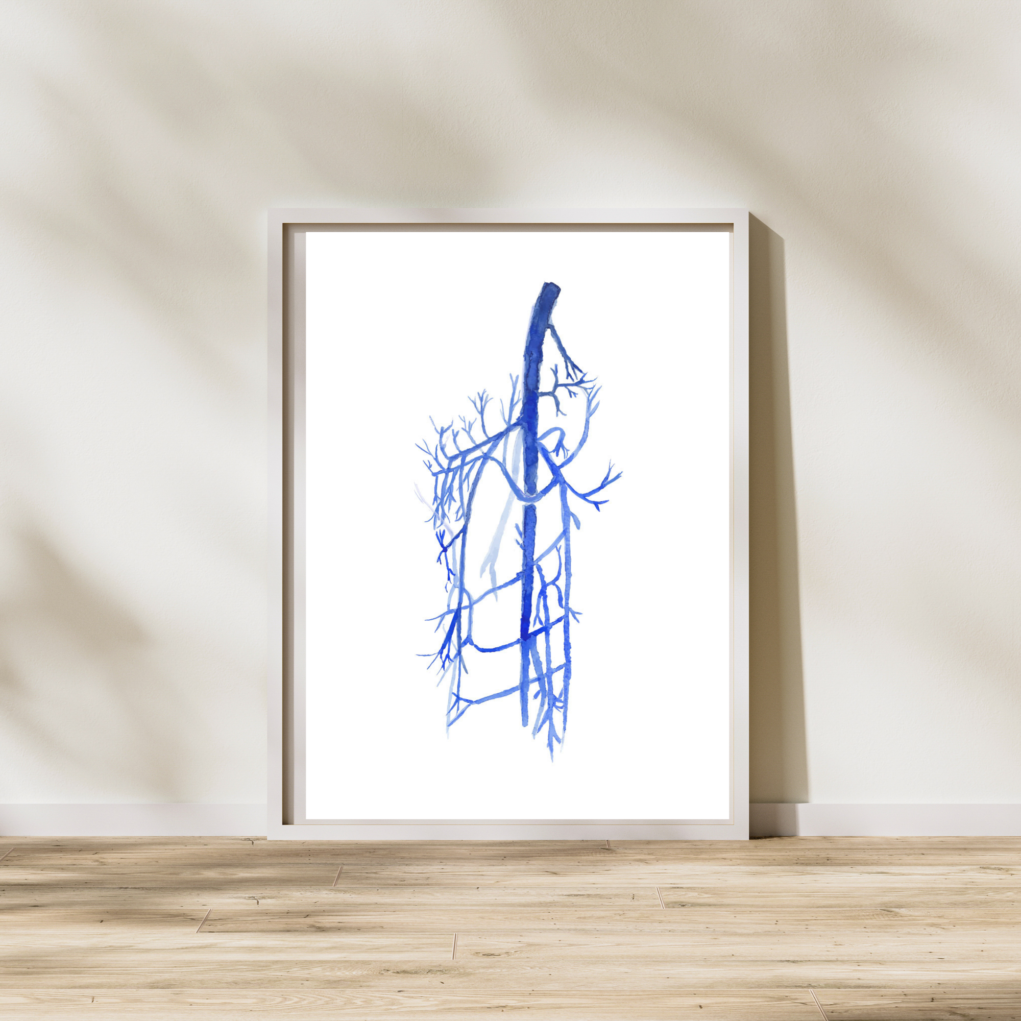 External Iliac, Femoral, Saphenous Vein Anatomy, Lower Limb Anatomy, Venography, Phlebography, Vascular Surgery Art Print, Varicectomy