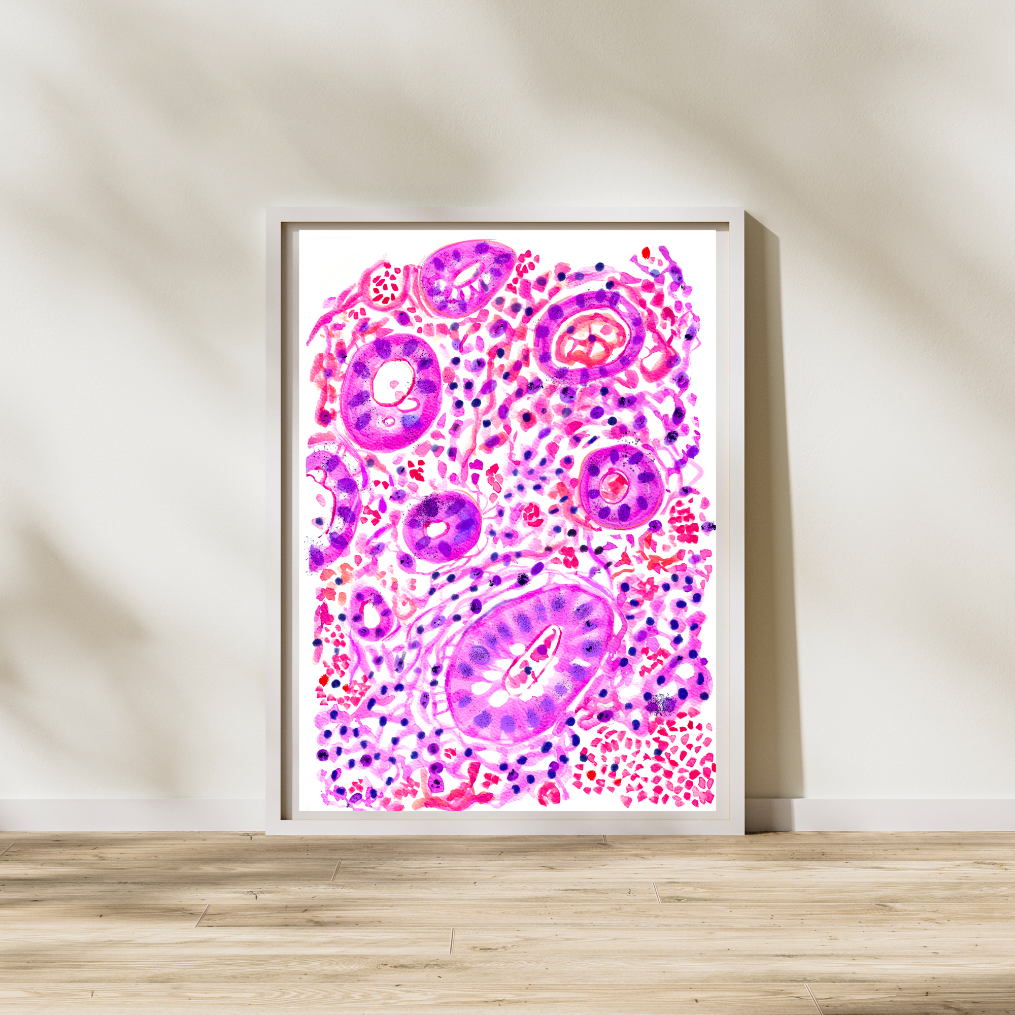 colitis ulcerosa art print