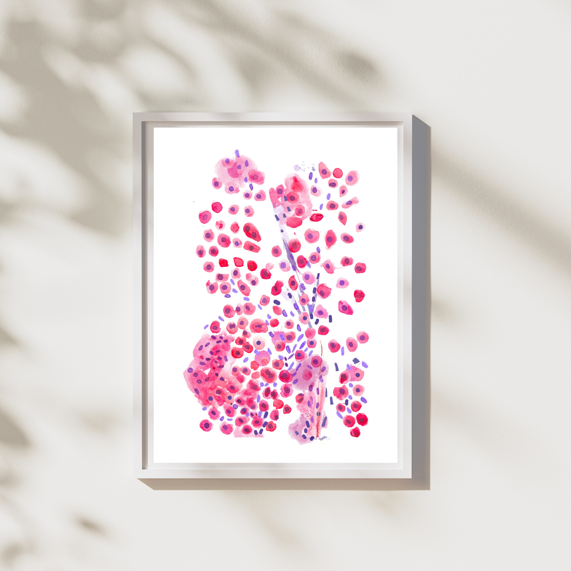 hepatocellular carcinoma awareness art print