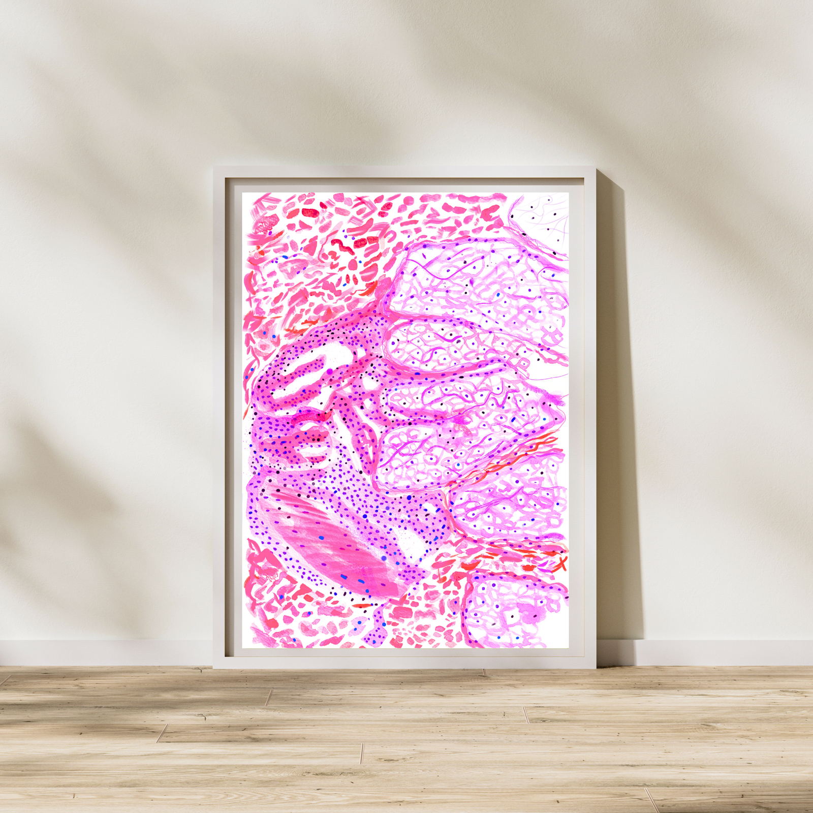 leprosy skin histopathology art