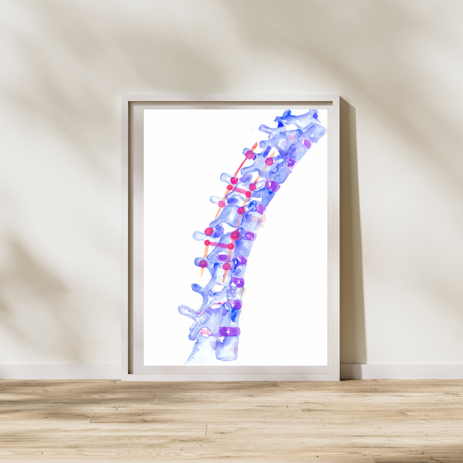 Spine Surgery Art Print