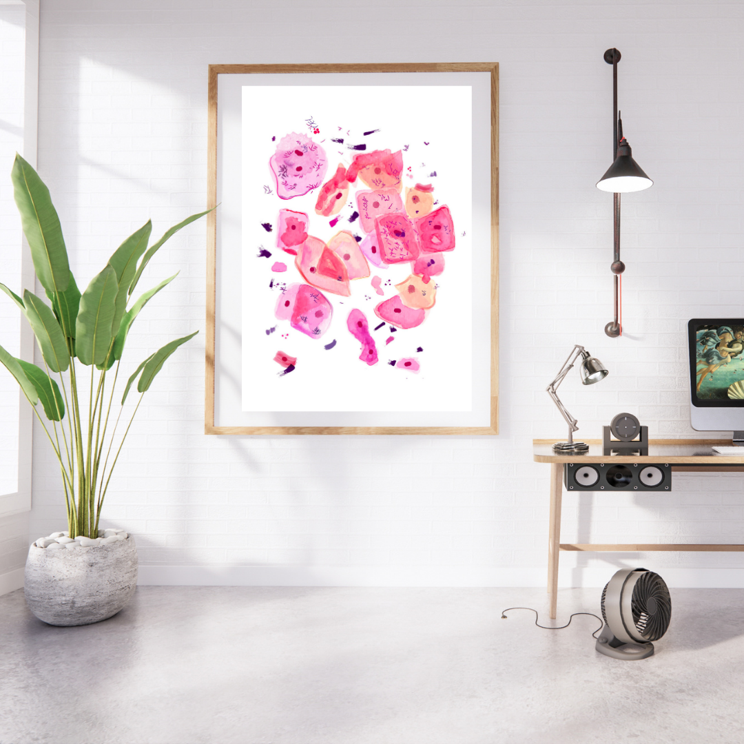 Bacterial Vaginosis Pathology Art Print