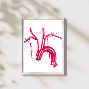 Aorta Anatomy Art Print