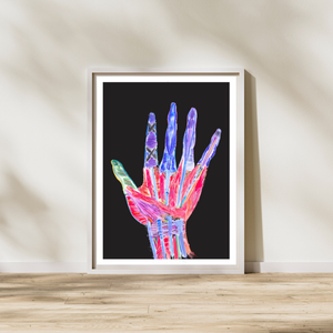 hand surgery art print
