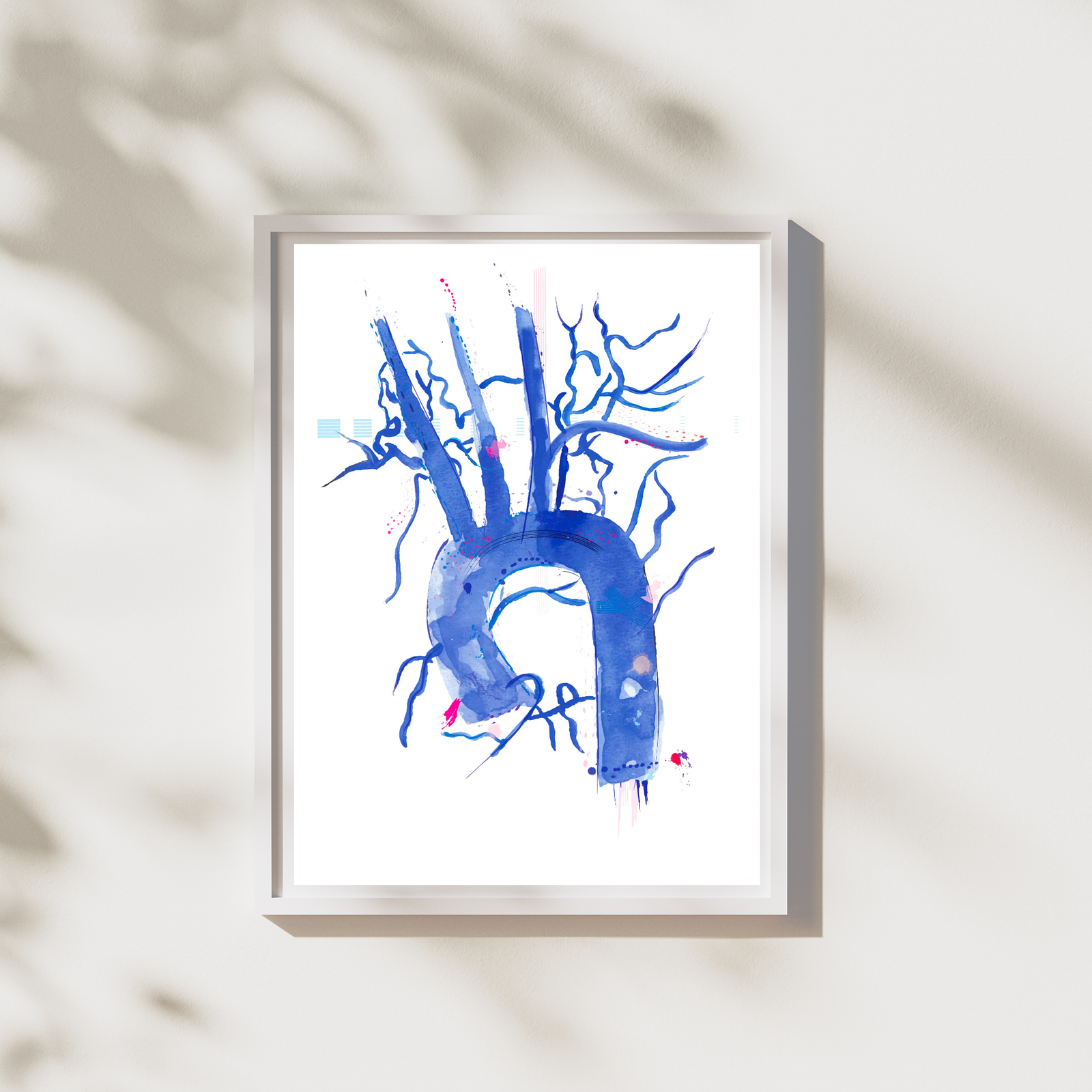 Aorta Anatomy, Cardiology Art Print, Interventional Radiology Wall Art
