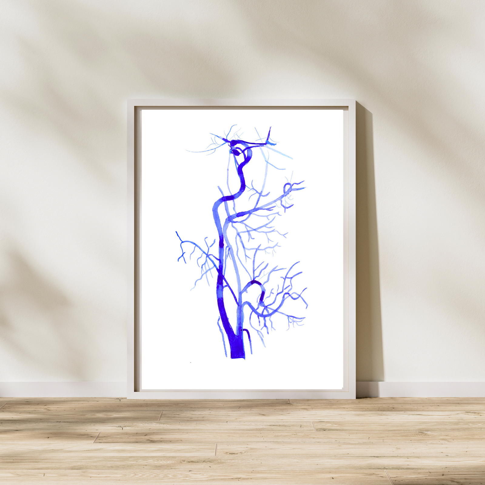Carotis Angiography Radiology Art Print