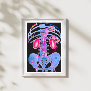 Abdominal CTA Aorta, Kidney Vascular Abstract Anatomy Art Print