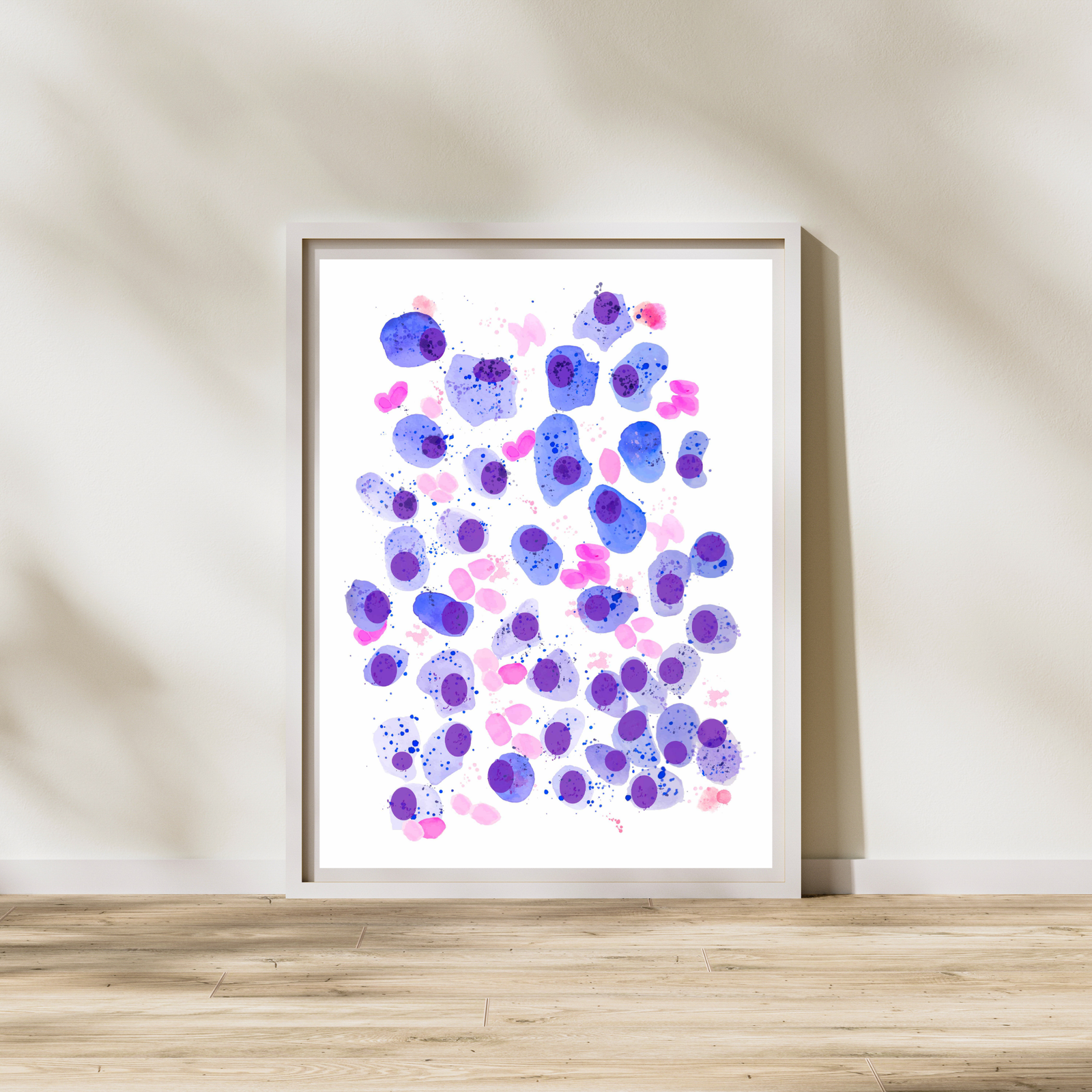 Multiple Myeloma Pathology Art