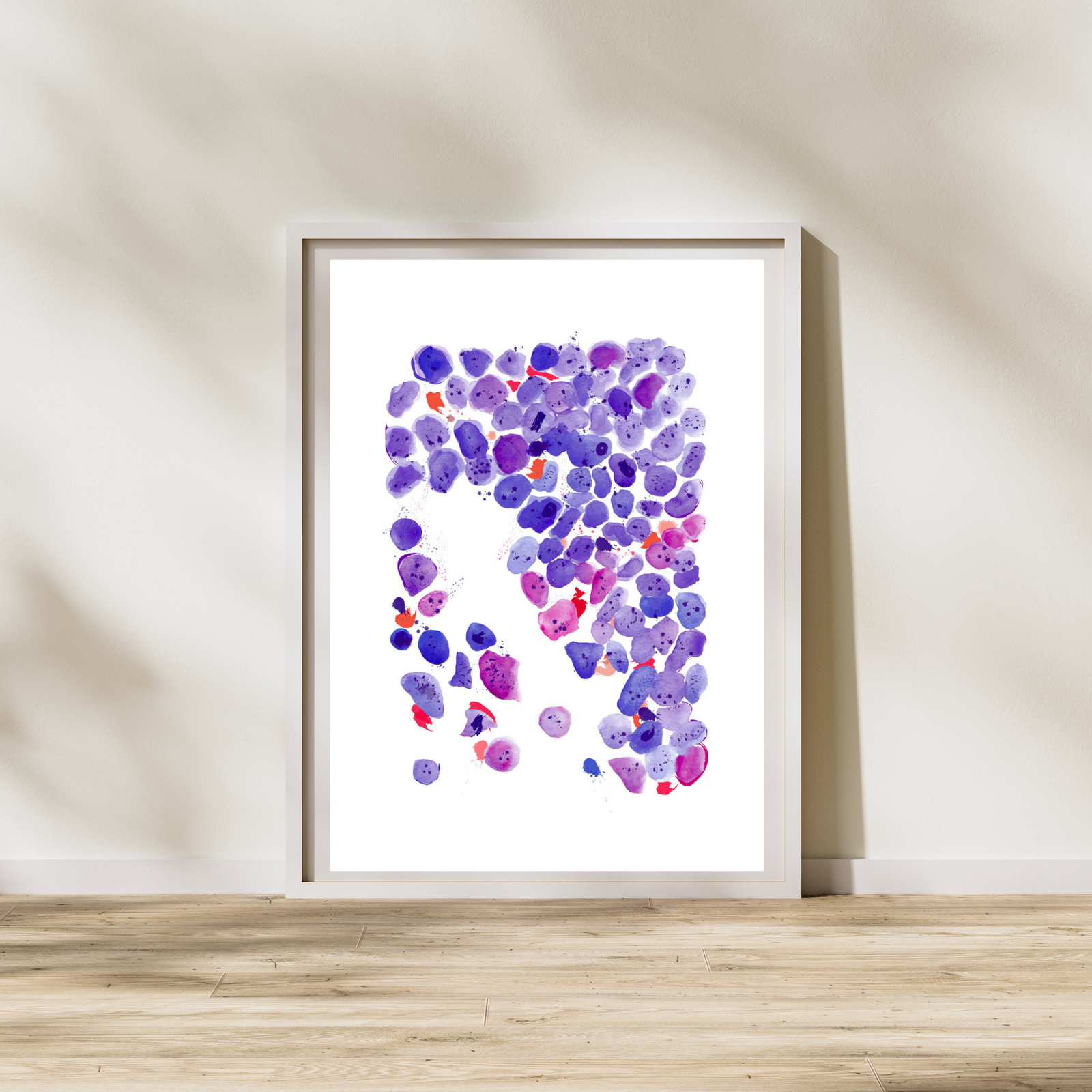 Acute Myeloid Leukemia Art Print
