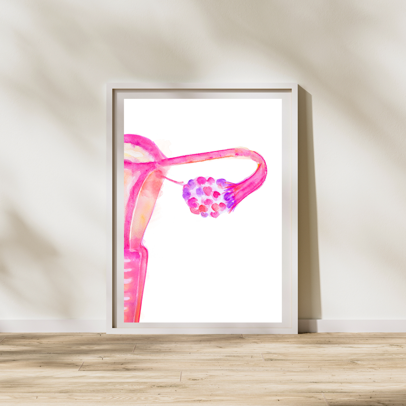 Polyendocrine Metabolic Ovarian Syndrome PMOS - PCOS Abstract Uterus Anatomy Art Print