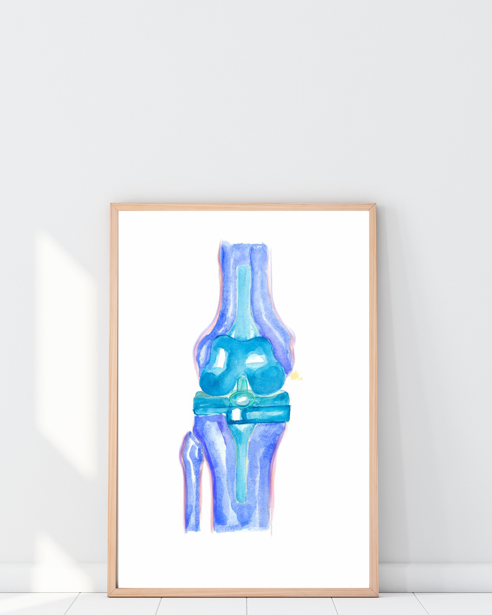 Knee Replacement Orthopedic Surgery Art