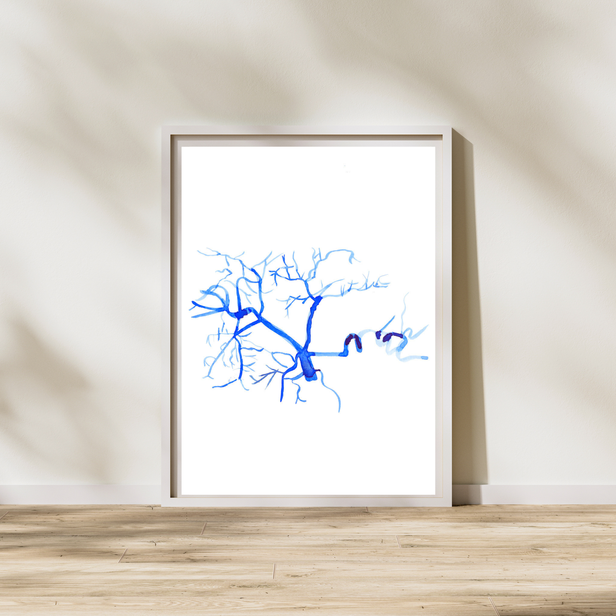 Celiac Trunk Arteriogram Interventional Radiology Vascular Gastroenterology Surgery Art Print