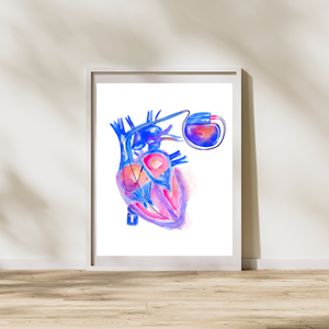 Pace Maker Heart anatomy Art Print