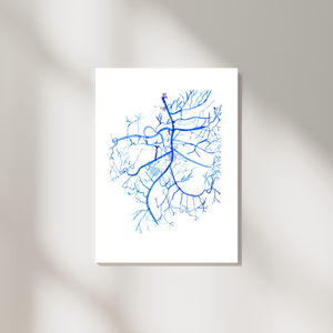 Mesenteric Arteries Angiography