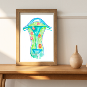 Uterine Fibroids Art Print for OBGYN Offices