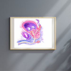 Prostatic Benign Hyperplasia Urology Artwork