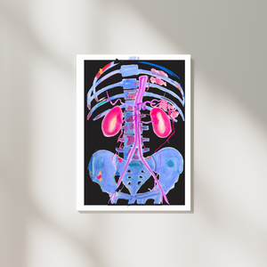 Abdominal CTA Aorta, Kidney Vascular Abstract Anatomy Art Print