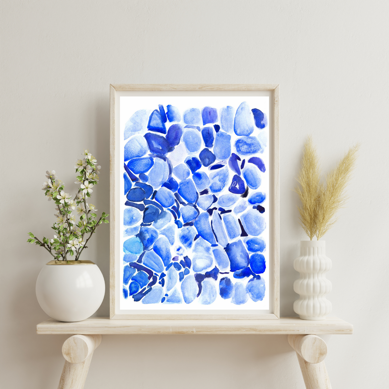 ALS Pathology Art Print