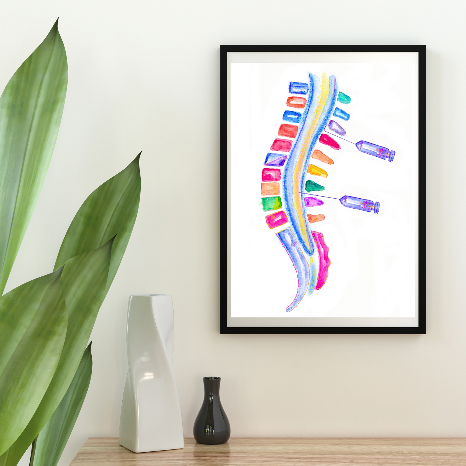 Spinal Block vs Epidural Anesthesia Art Print