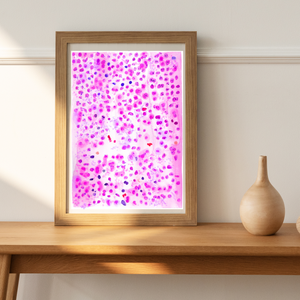 Large B Cell Lymphoma with IRF4 Oncohematology Art Print