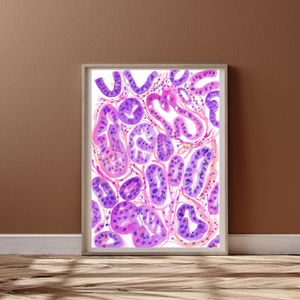 Ovarian Cancer Histopathology Art