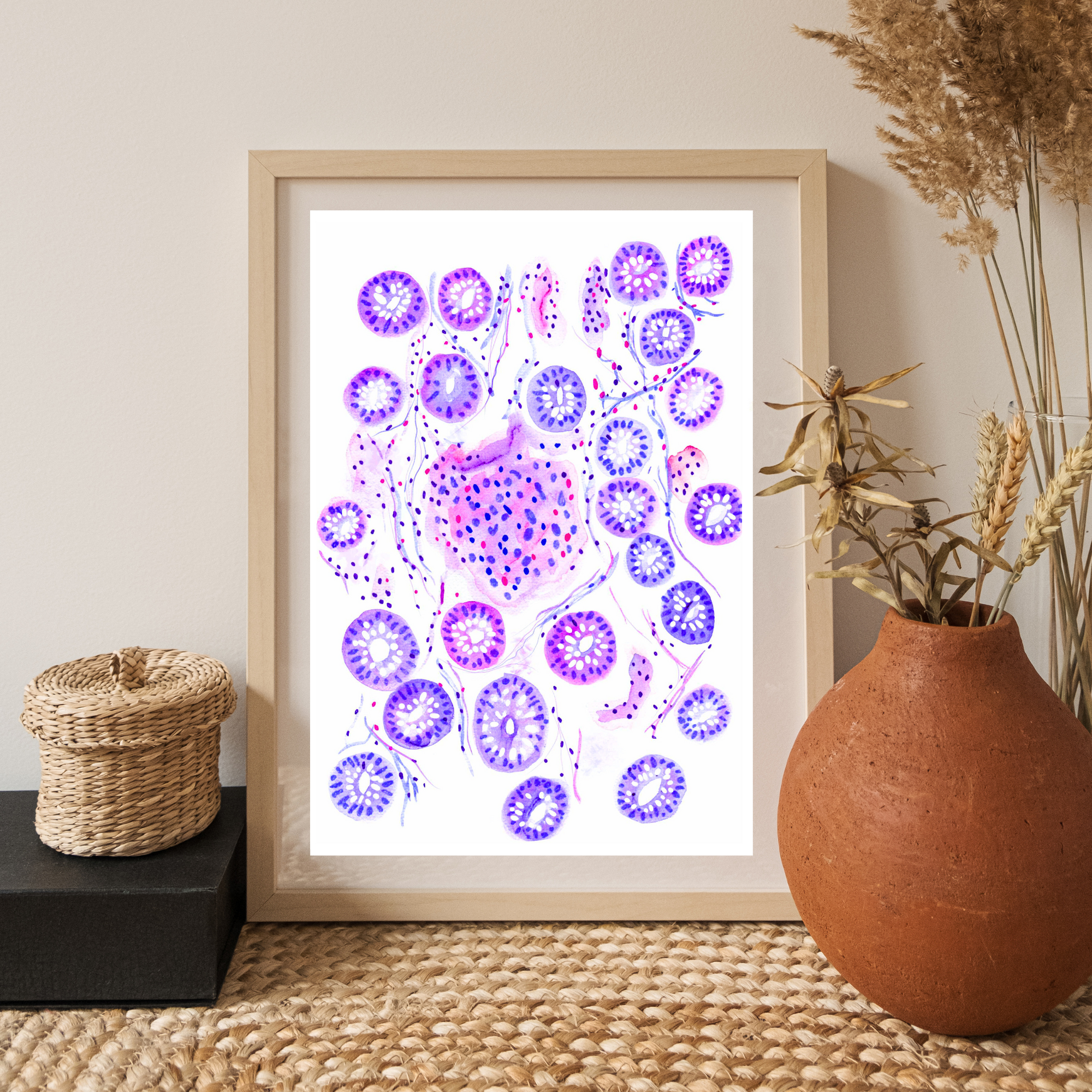 Crohn´s Disease Histopathology Art Print