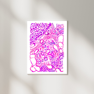 Diabetes Art, Pathology Art, Histopathology Art, Pathology Assistant, Diabetes type 2, Pathologist Gifts, Diabetes Poster, Pancreas