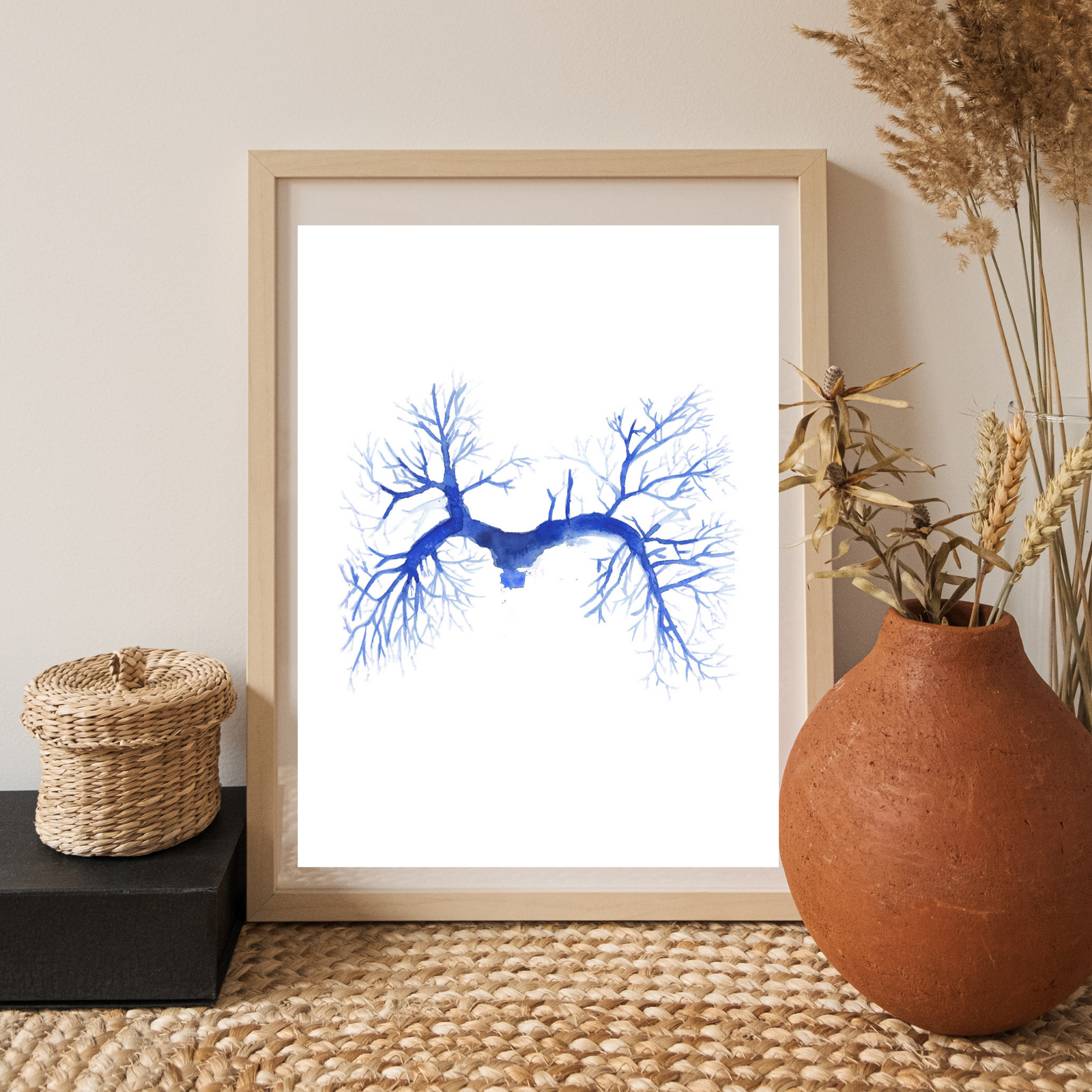 Pulmonary Embolism CT Angiography Watercolor Art Print