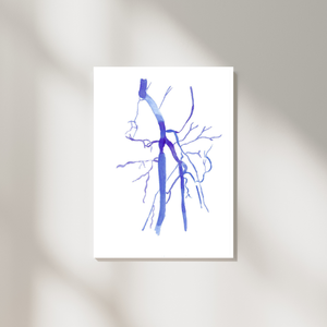 Femoral Artery Occlusion DSA Watercolor Anatomy Art Print