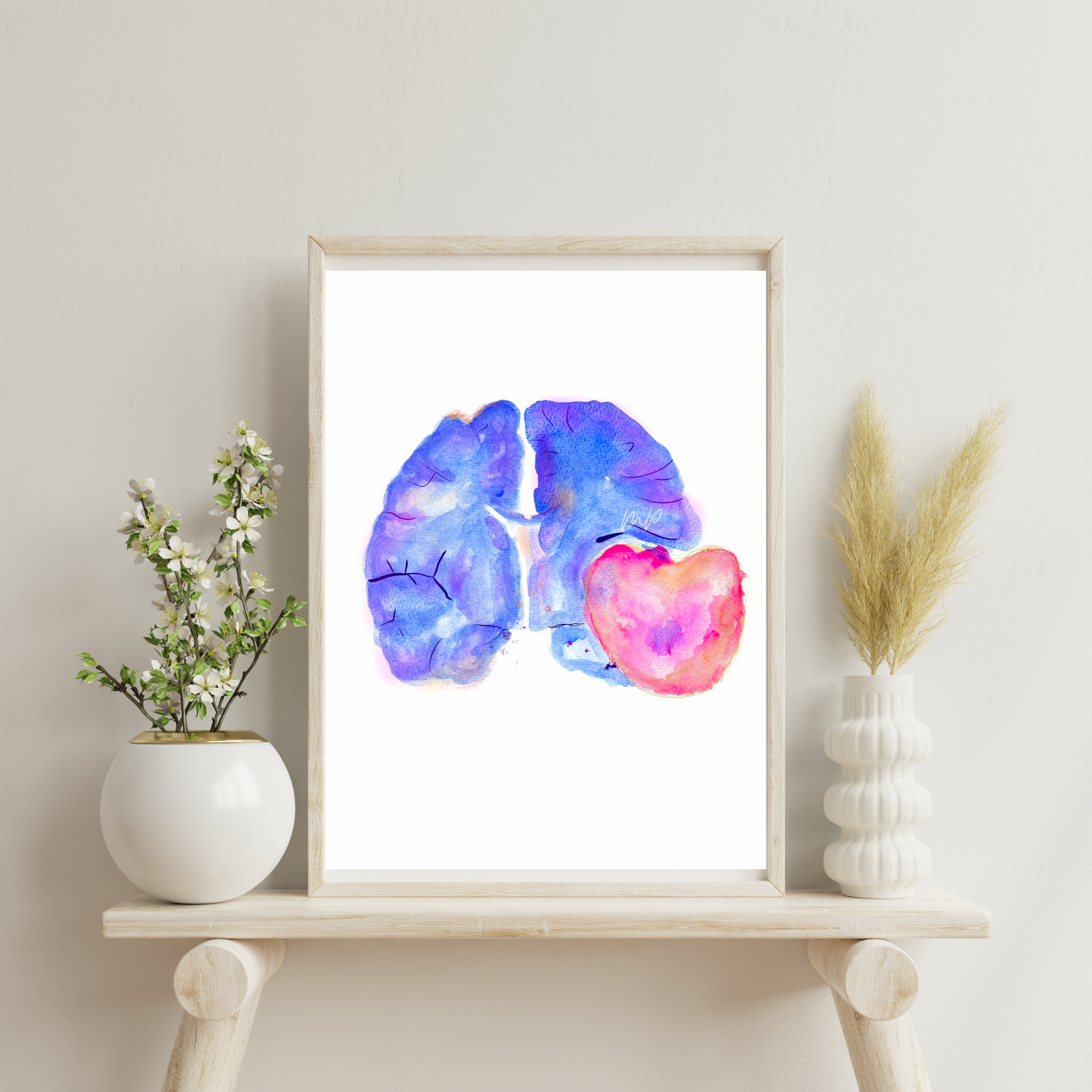 Meningioma Brain Section Anatomy Watercolor Art Print