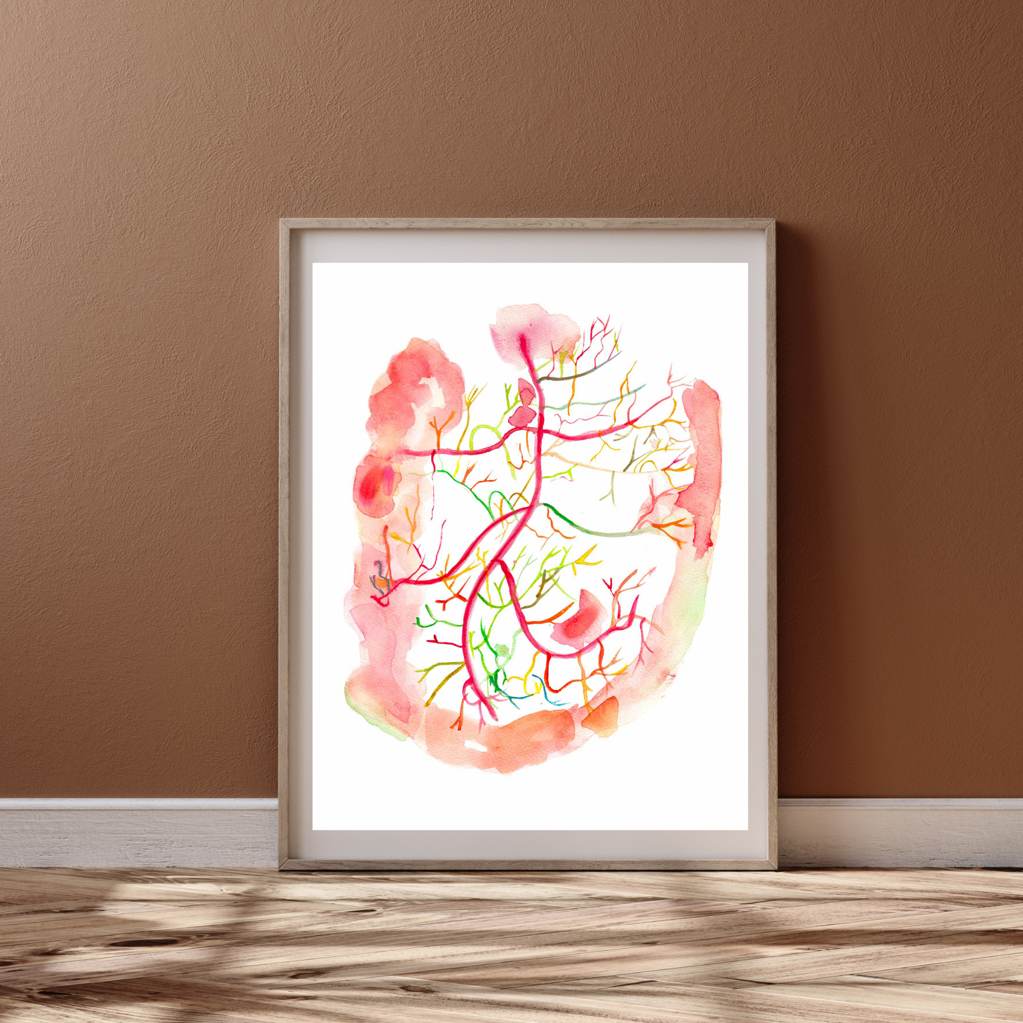 Mesenteric Arteries Angiogram