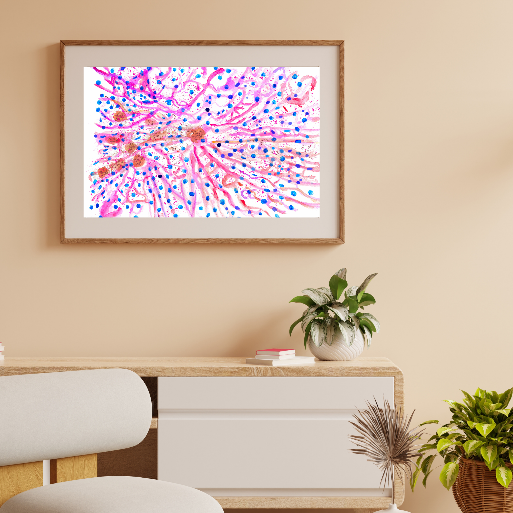 hematochromatosis art print
